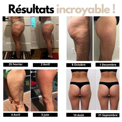 Legging Anti-Cellulite